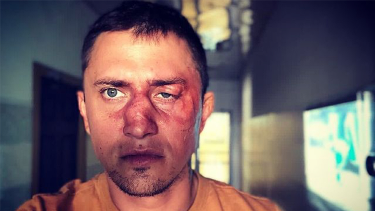 Драка прилучного в калининграде