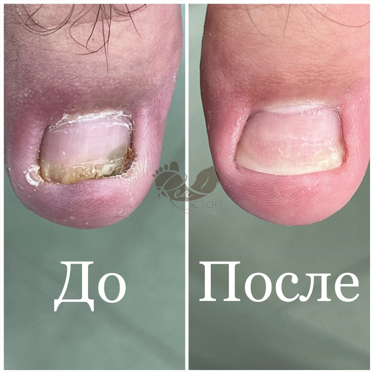 Первый подологический центр калининград