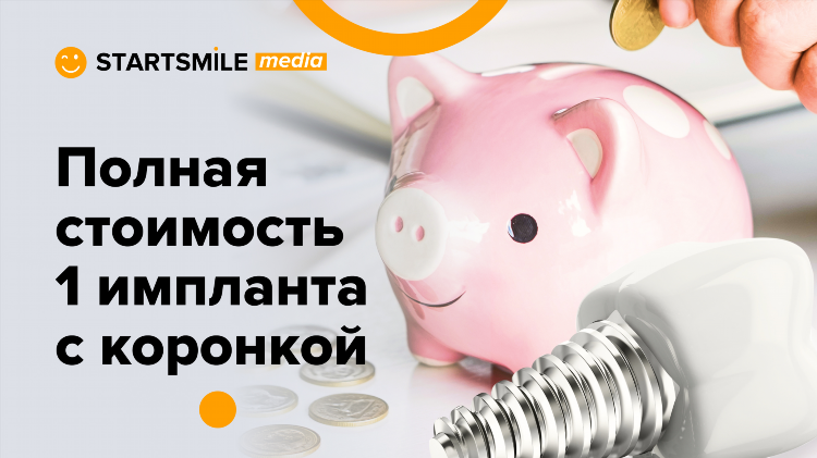 Стоимость имплантов в калининграде